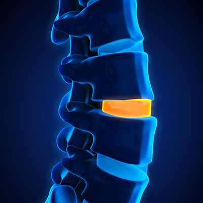 spinal-discs