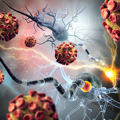 medical illustration of autoimmune disease