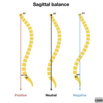 How Spine Alignment Affects Your Balance