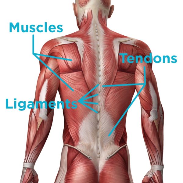 Muscle or Ligament Strain