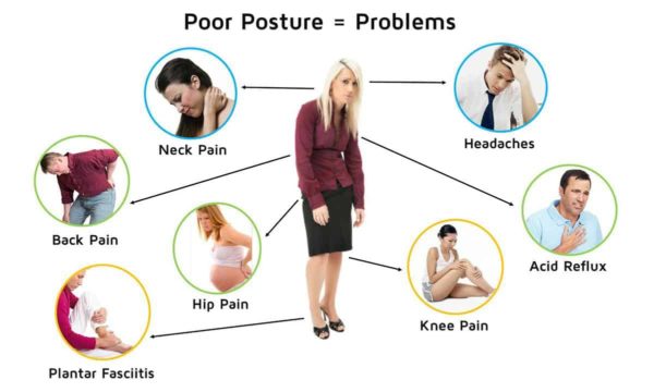 Poor Posture Treatment