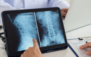 What Is Digital Motion X-Ray?