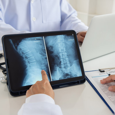 What Is Digital Motion X-Ray?