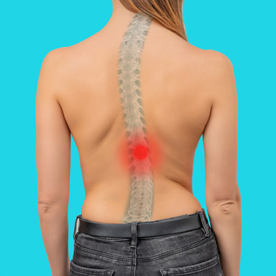 Can a Chiropractor Fix Mild Scoliosis?