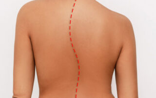 is scoliosis genetic
