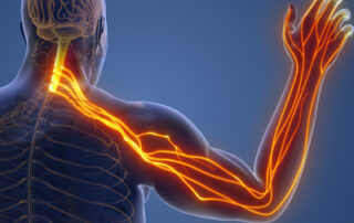 pinched nerve in the arm