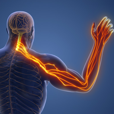 pinched nerve in the arm
