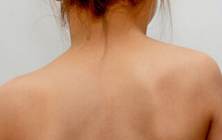 Uneven Shoulders