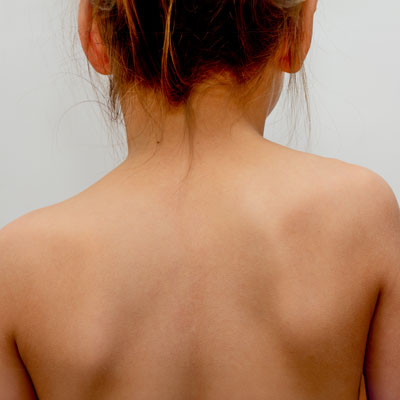 Uneven Shoulders
